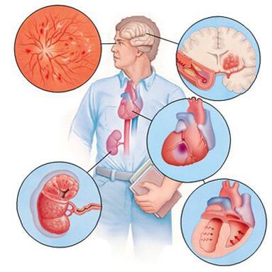 Cardiol previene lo sviluppo di malattie concomitanti